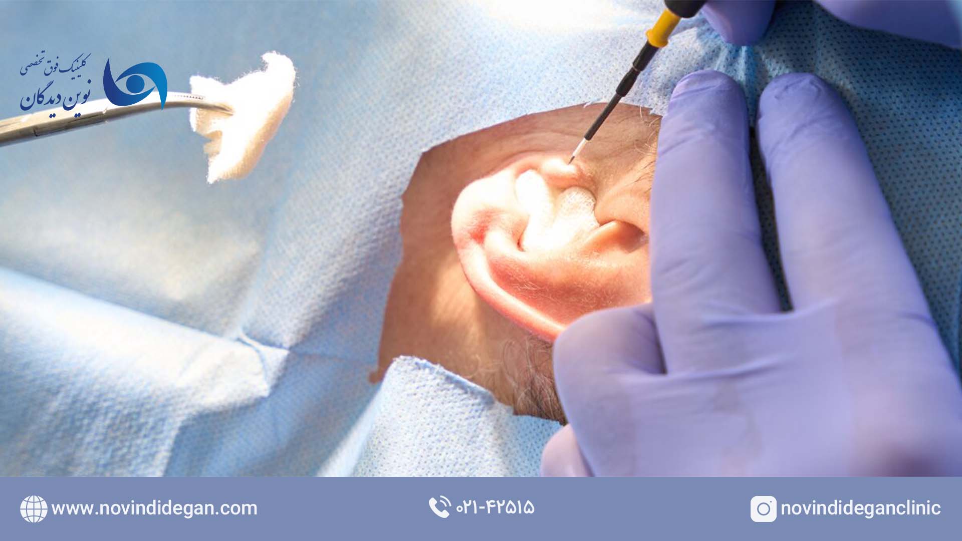 تمپانوماستوئیدکتومی تمپانوماستوئیدکتومی