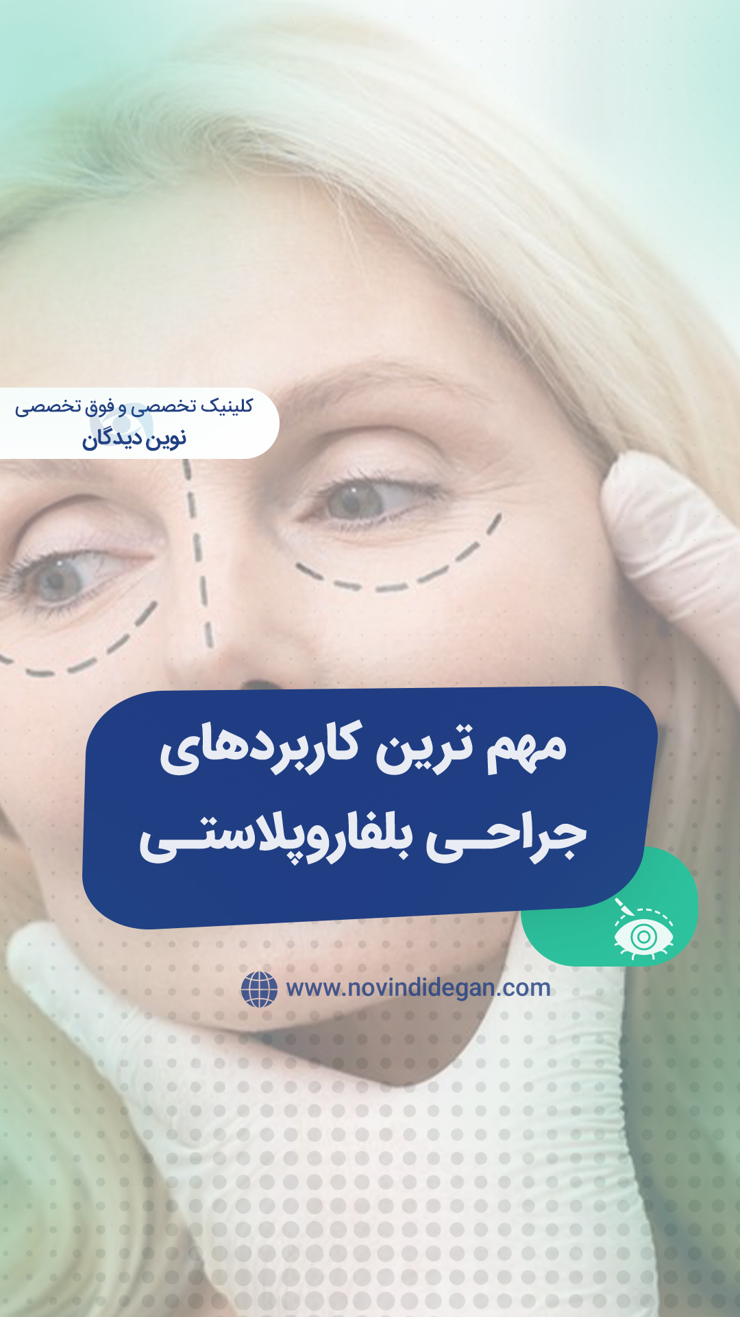 مهم ترین کاربردهای جراحی زیبایی پلک (بلفاروپلاستی)