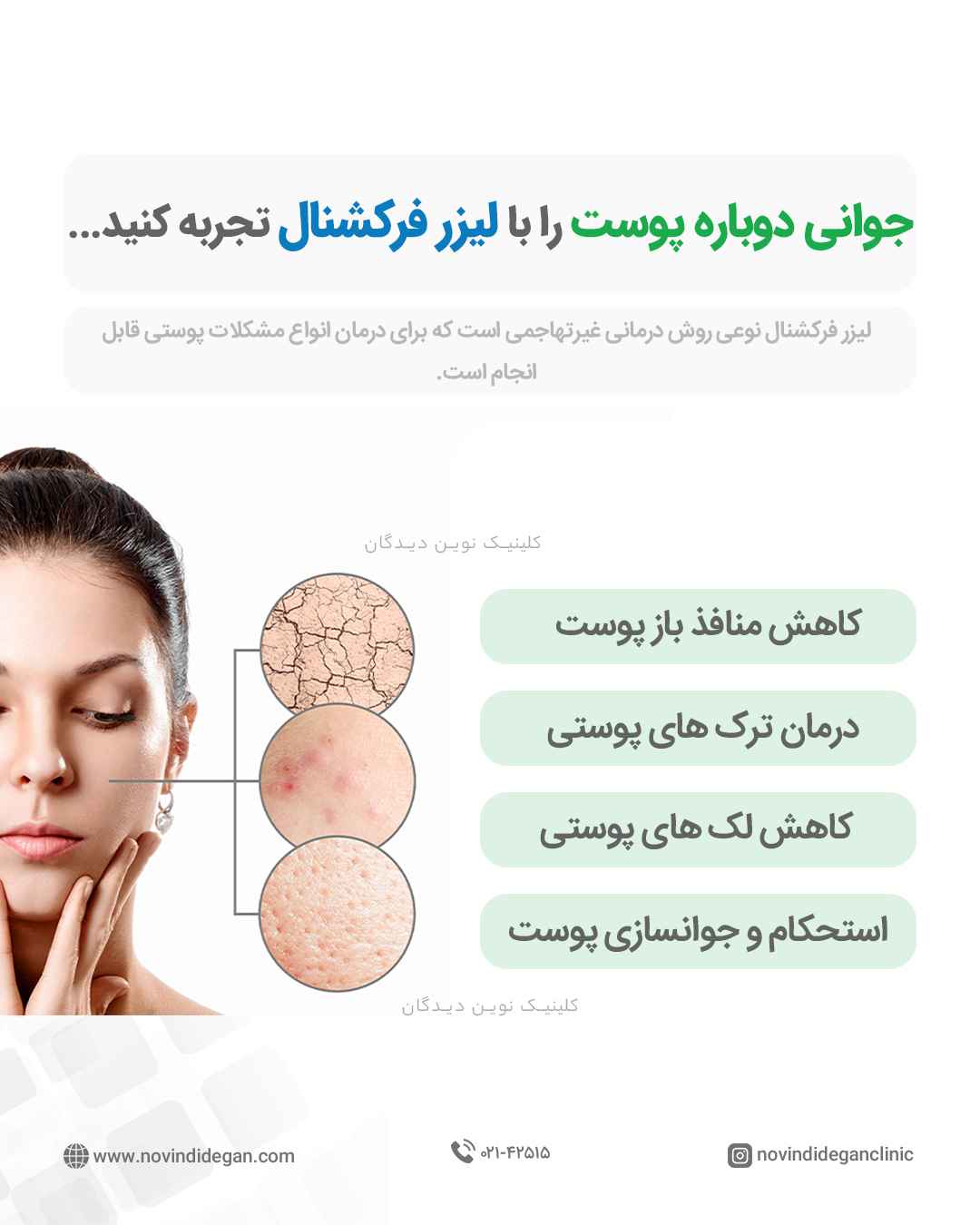 لیزر فرکشنال