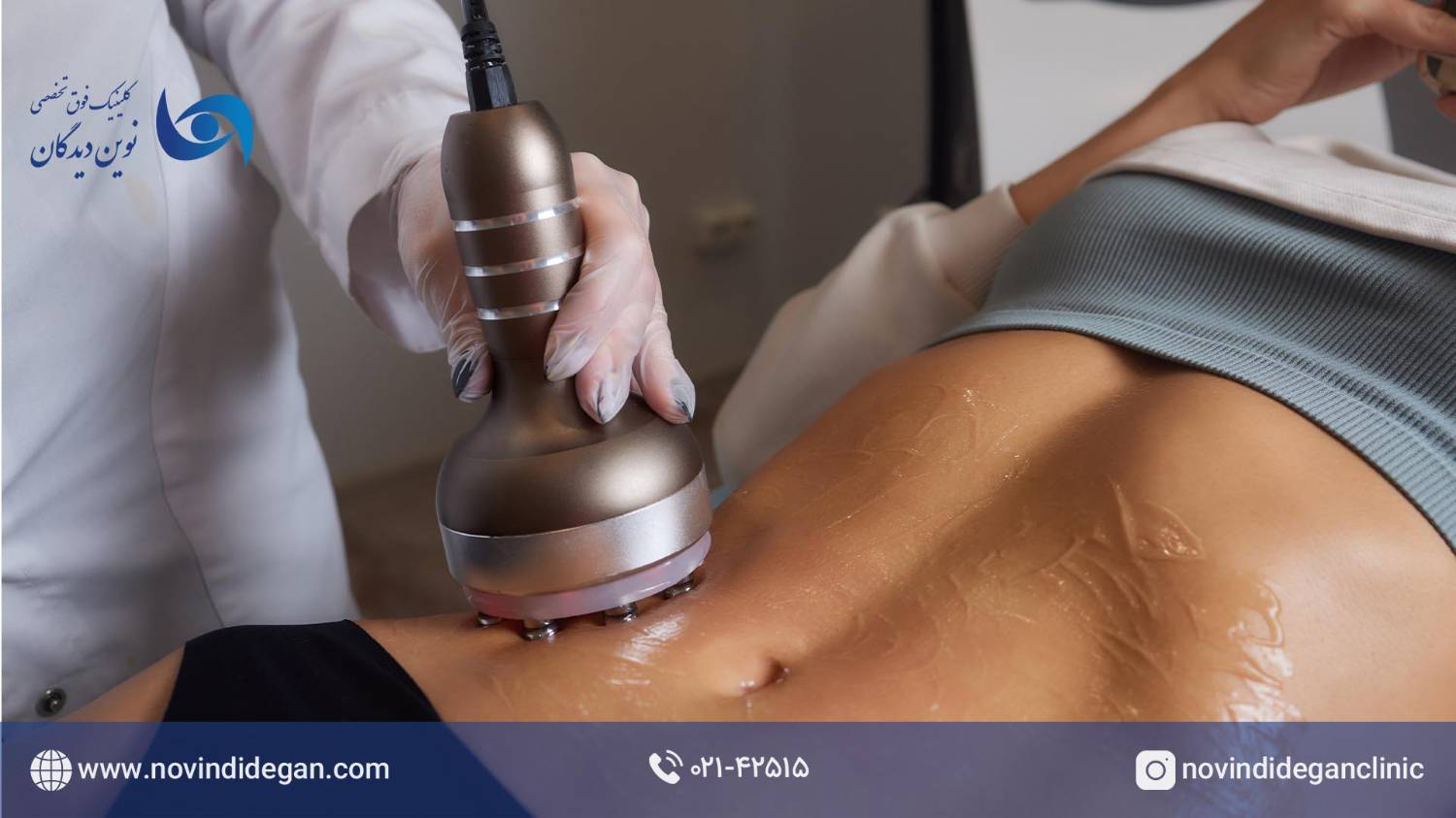 لاغری با RF VACCUM لاغری با RF VACCUM