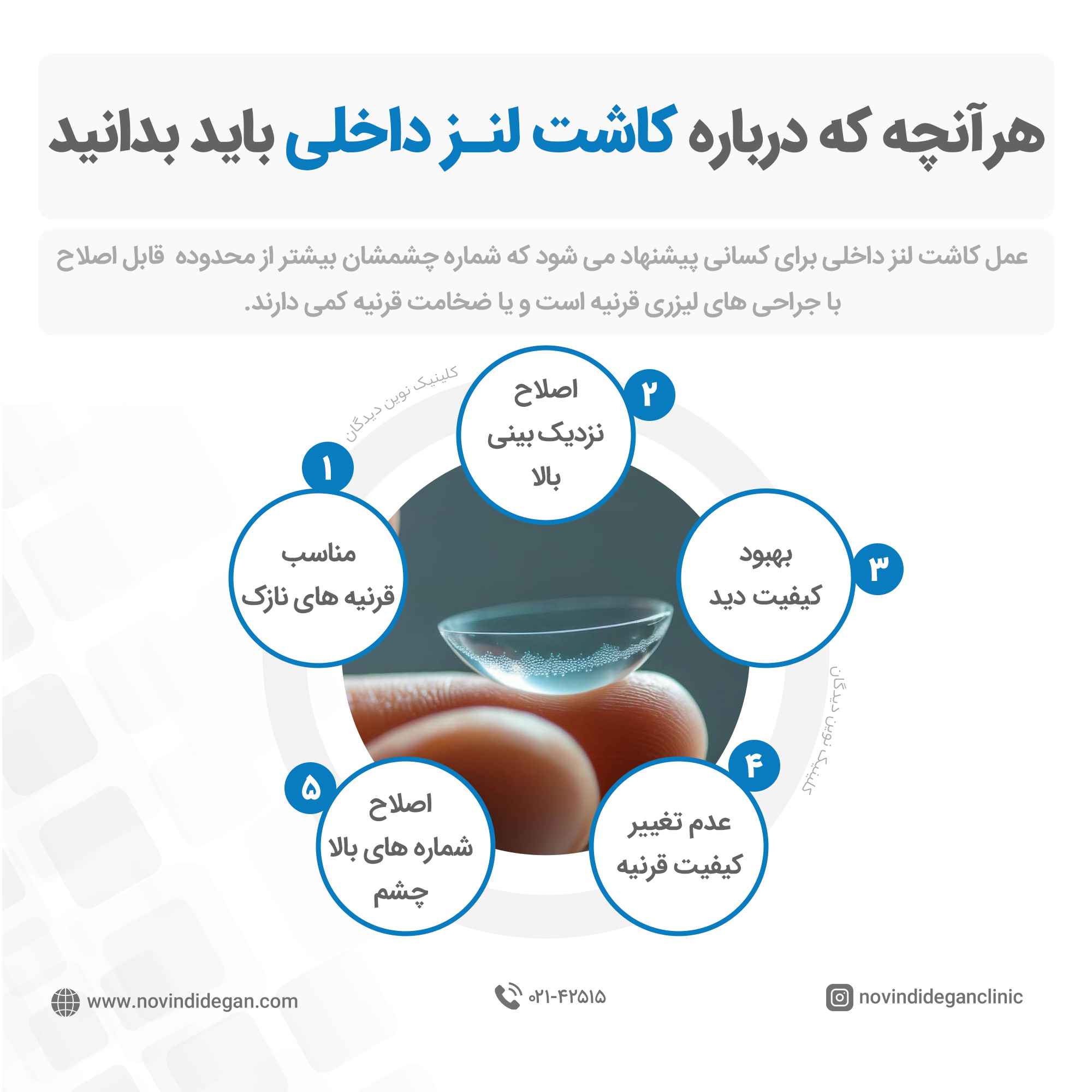 کاشت لنز دائمی کاشت لنز دائمی