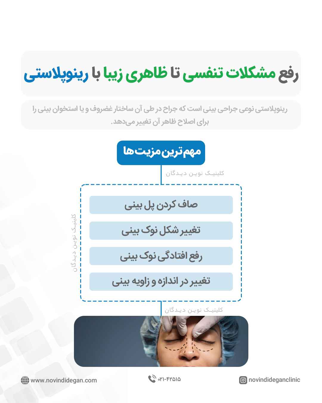 عمل رینوپلاستی