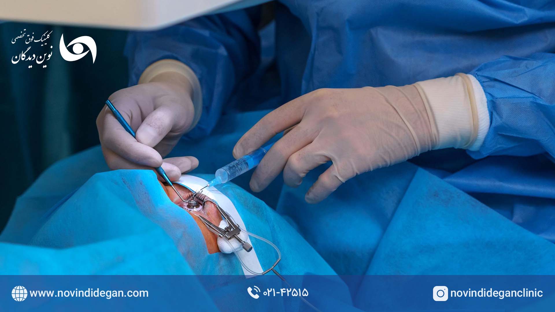 جراحی ویترکتومی جراحی ویترکتومی